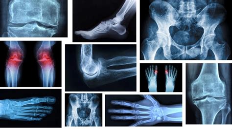 dosm physical therapy|Danville Orthopaedic & Sports Medicine.